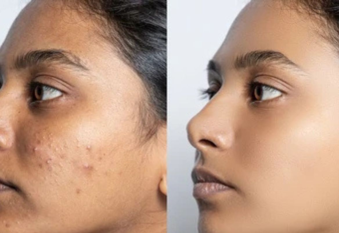 Skin Brightening Treatments That Actually Work