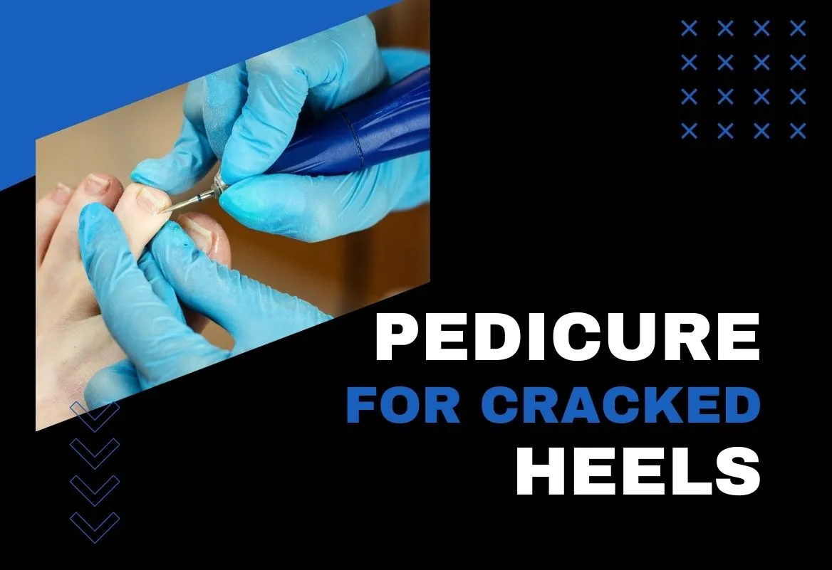Which Pedicure Is Best for Cracked Heels?